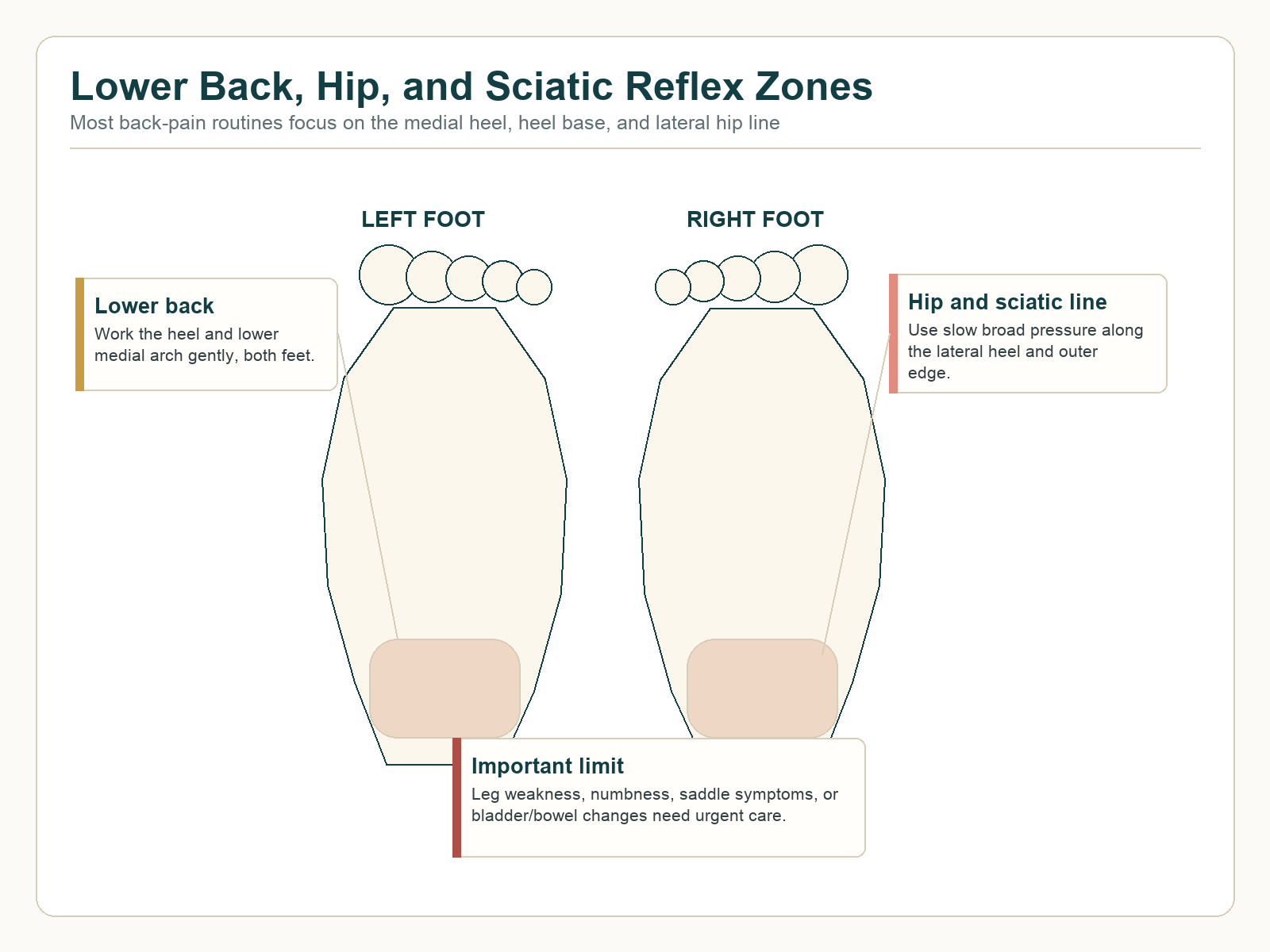 Lower back, hip, and sciatic foot reflexology zones showing bilateral heel and lateral heel areas with urgent care warning.