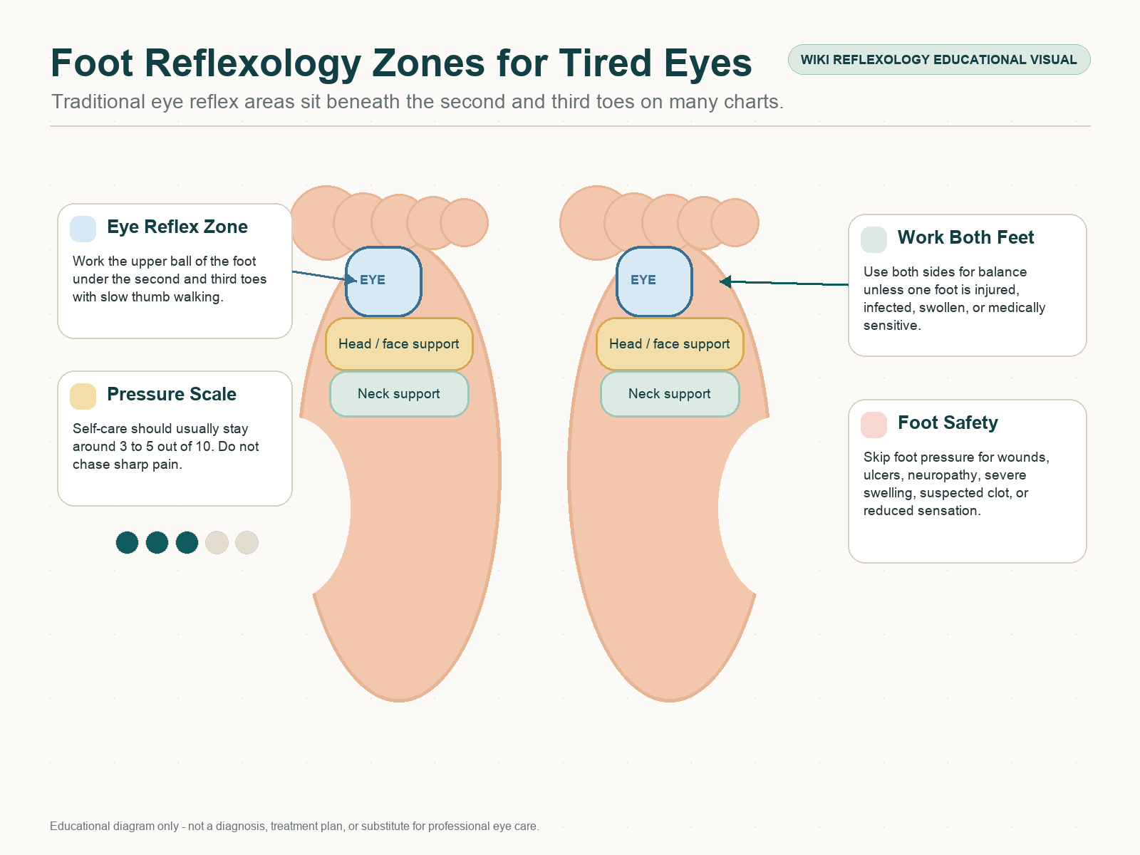 Foot reflexology zones for eye strain showing eye reflex areas under the second and third toes, head and face toe zones, neck support zone, and pressure safety scale.