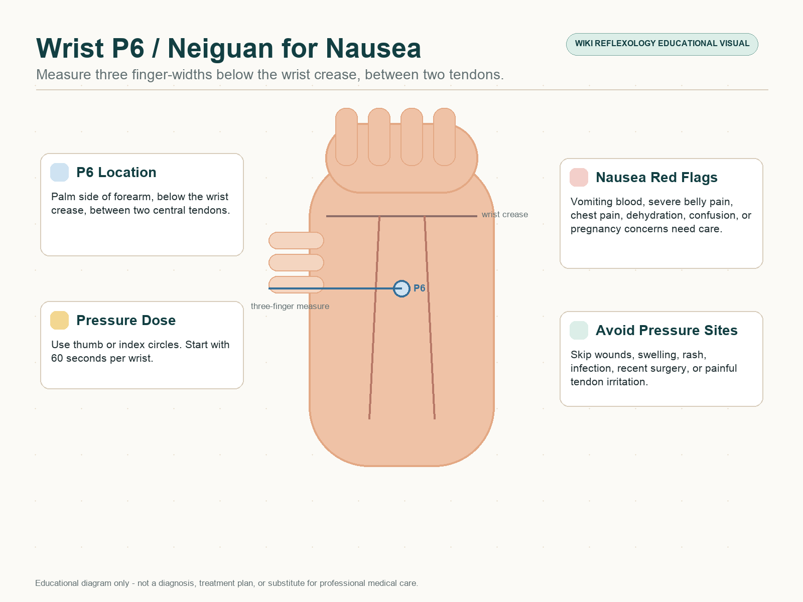 Wrist P6 Neiguan pressure point diagram for nausea support showing three-finger measurement below the wrist crease and two tendons.